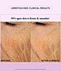 philosophy ultimate miracle worker nourish & rejuvenate face & neck moisturizer - Image 3