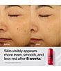 Shiseido Ultimune Strengthening Serum Set - Image 6