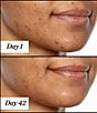 Sunday Riley U.F.O. Ultra-Clarifying Acne Treatment Face Oil - Image 2
