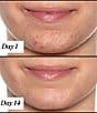 Sunday Riley U.F.O. Ultra-Clarifying Acne Treatment Face Oil - Image 3