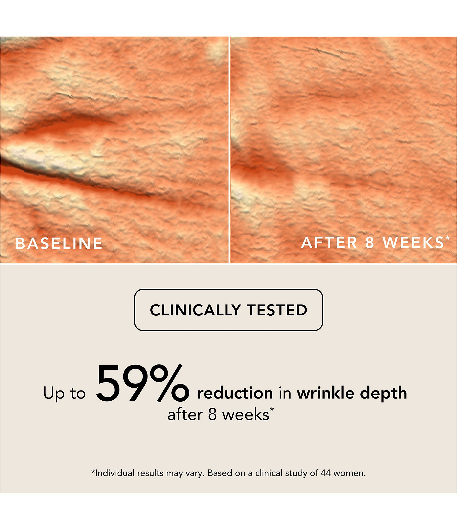 Chantecaille Bio Lifting Concealer