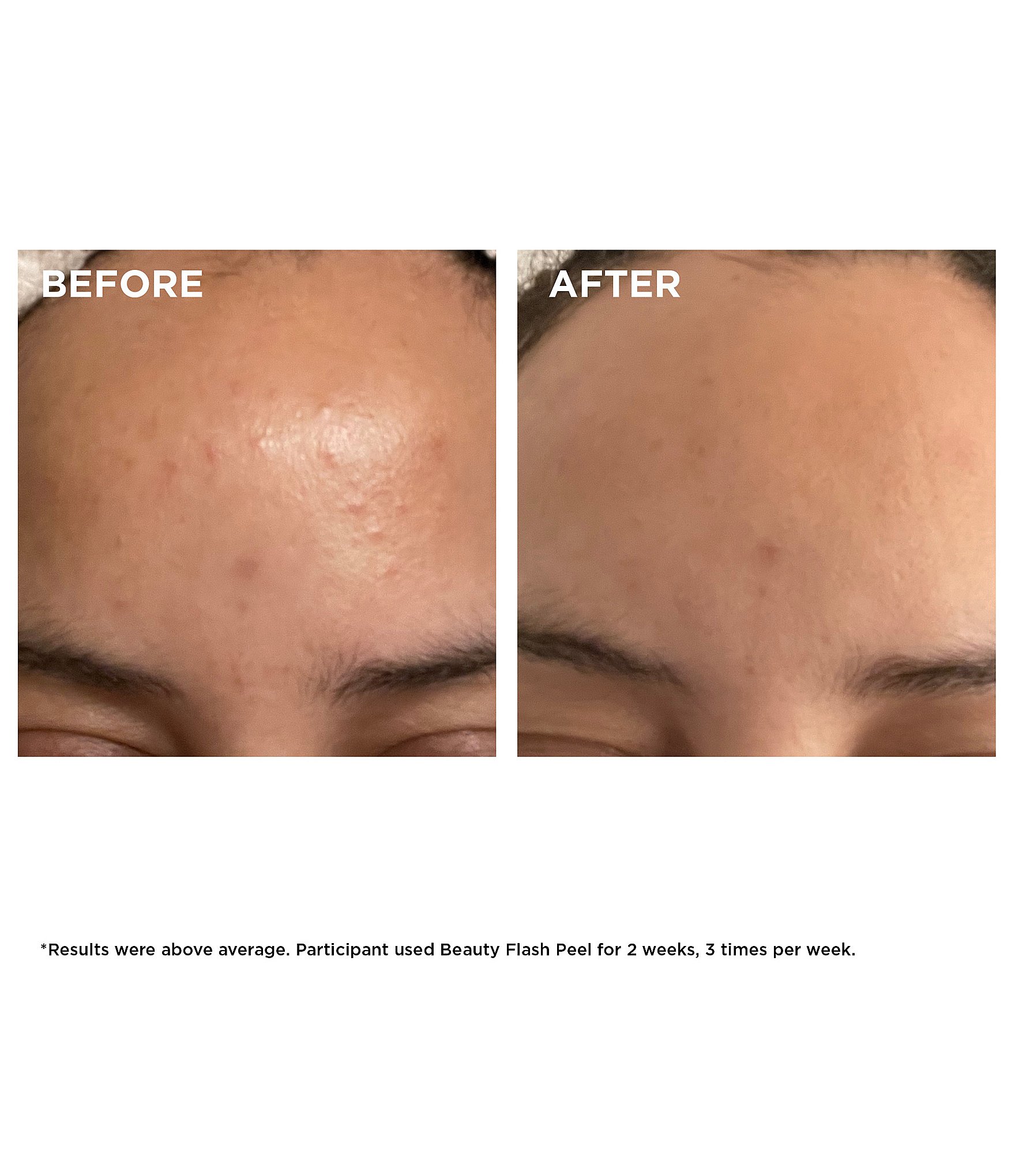 Clarins Beauty Flash Peel with BHA & AHA