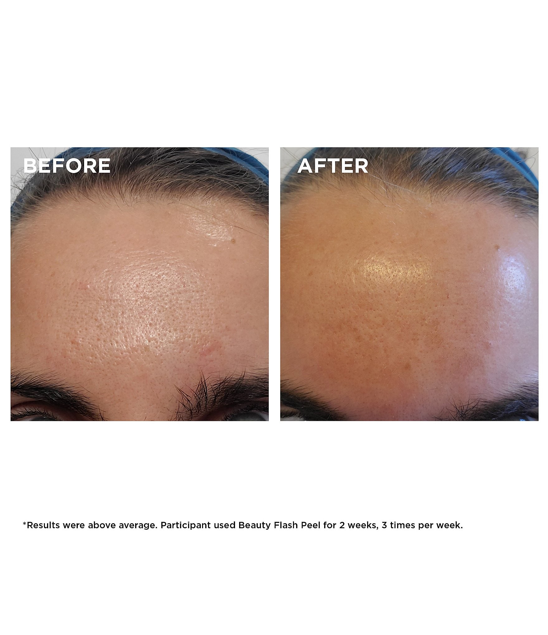 Clarins Beauty Flash Peel with BHA & AHA