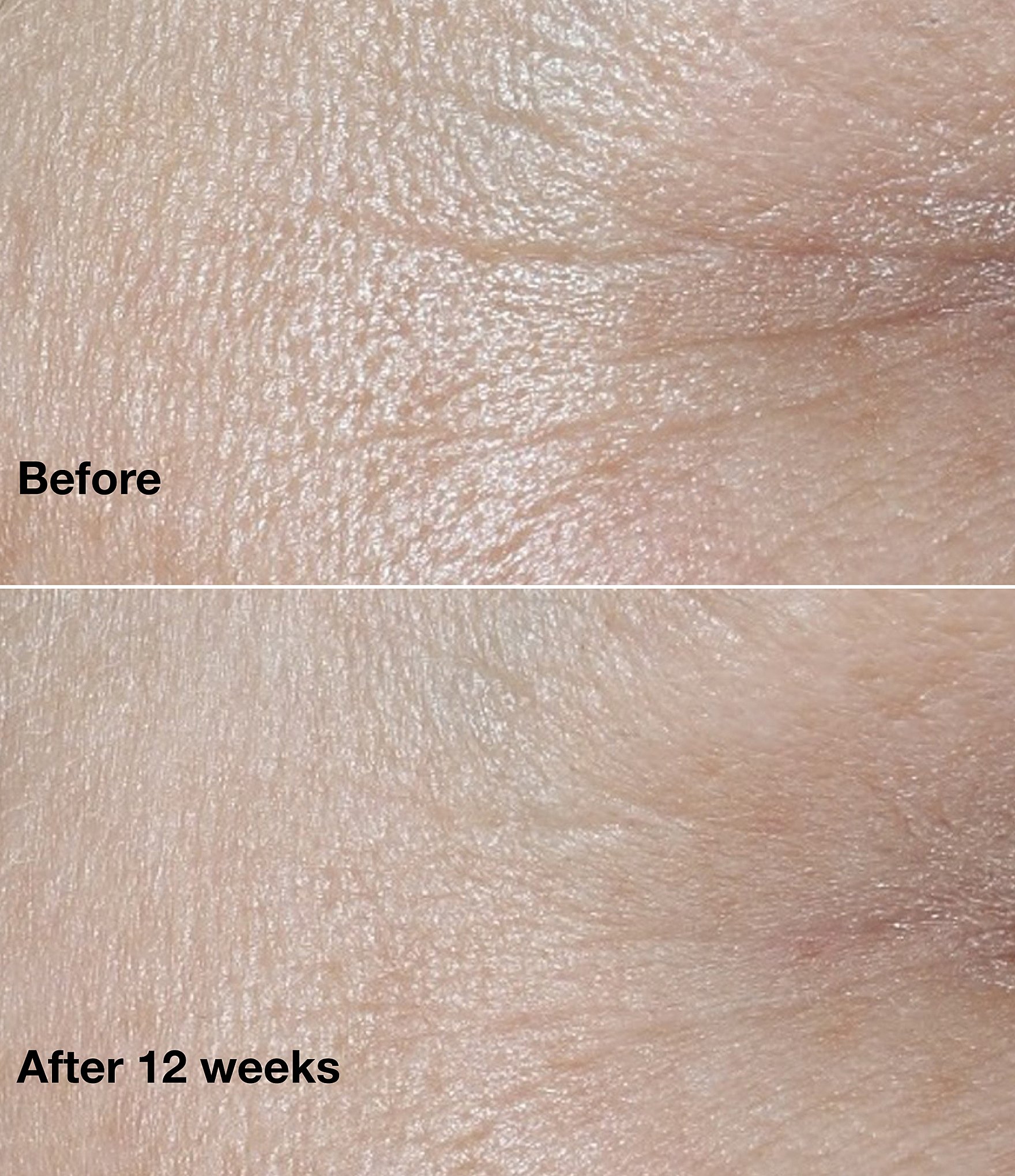 Clinique Smart Clinical Repair Wrinkle Correcting Rich Face Cream 0.5 oz.