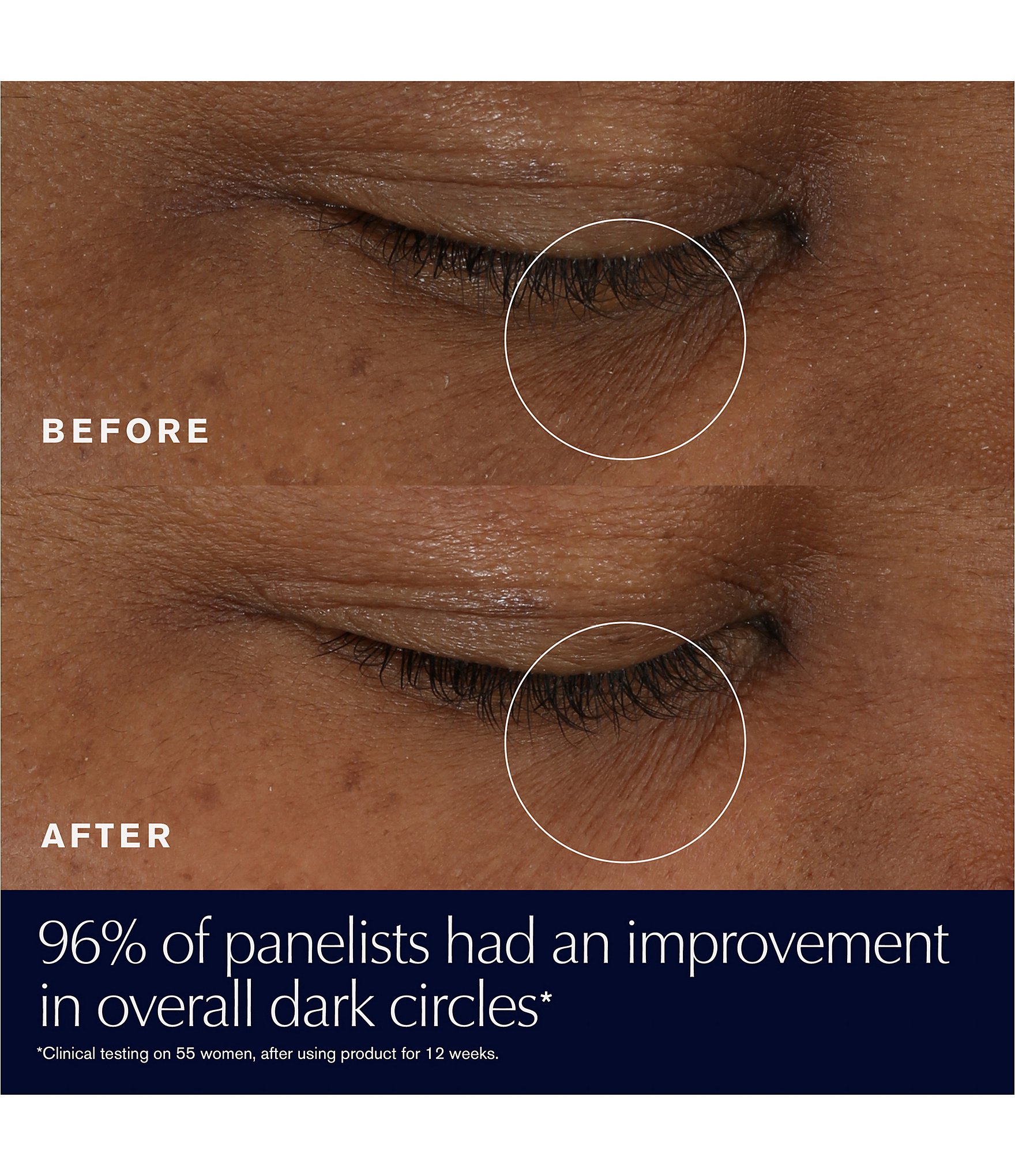 Estee Lauder Advanced Night Repair Supercharged Gel Eye Cream