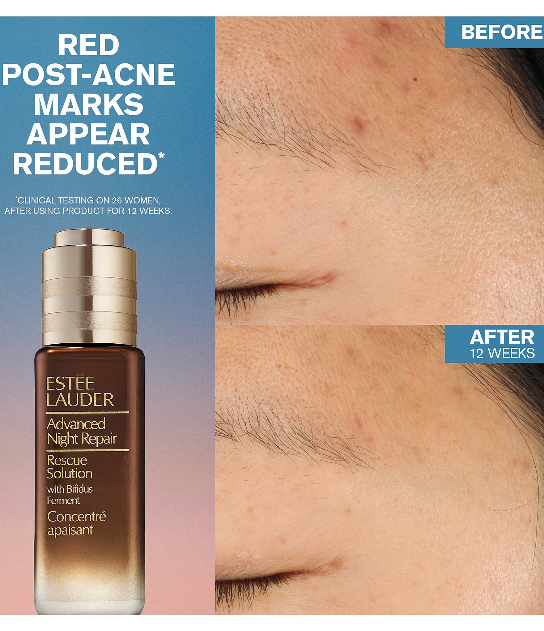 Estee Lauder Advanced Night Repair Rescue Solution Serum