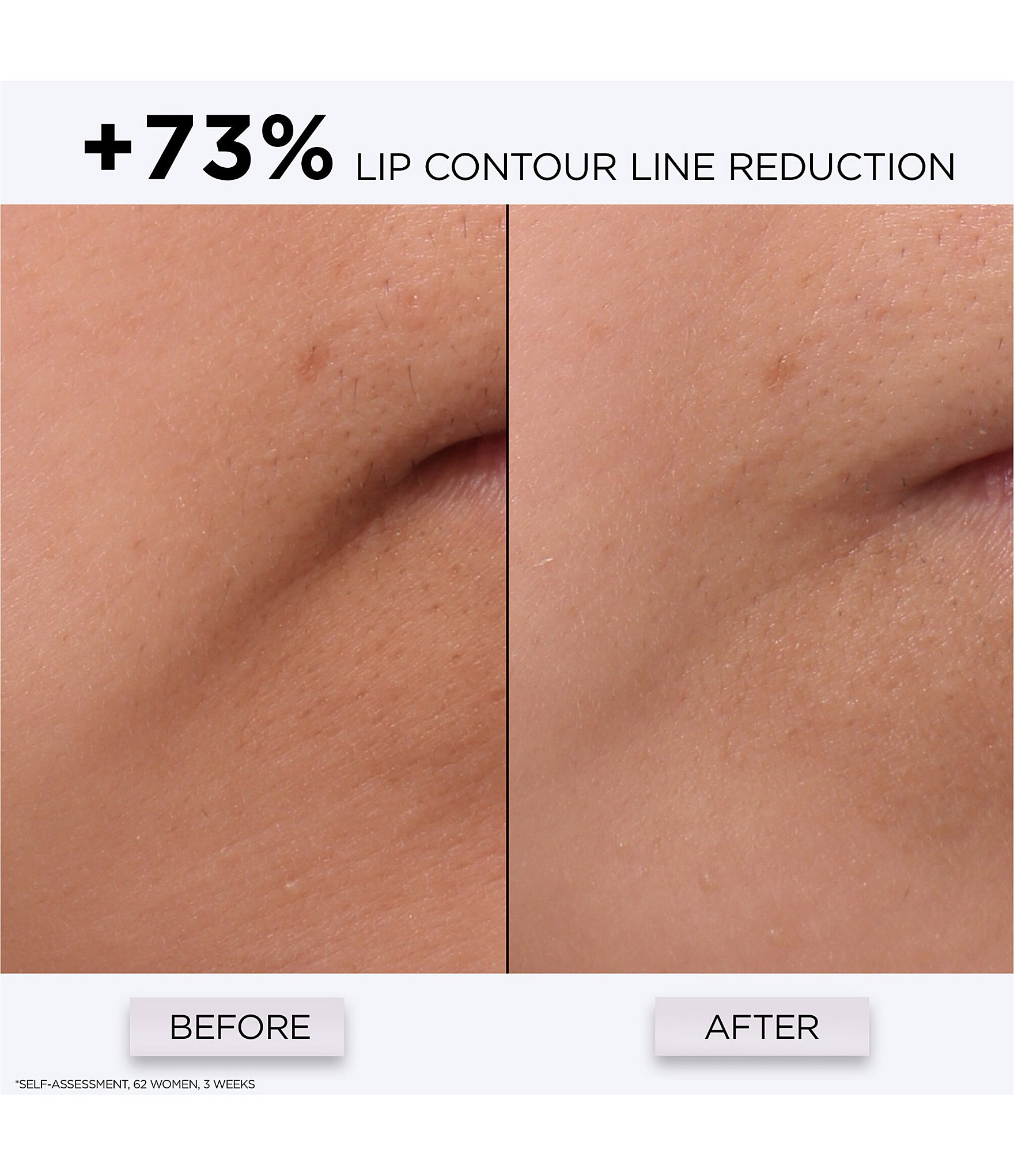 Lancome Genifique Multi Wrinkle Correction Repair Shot Serum