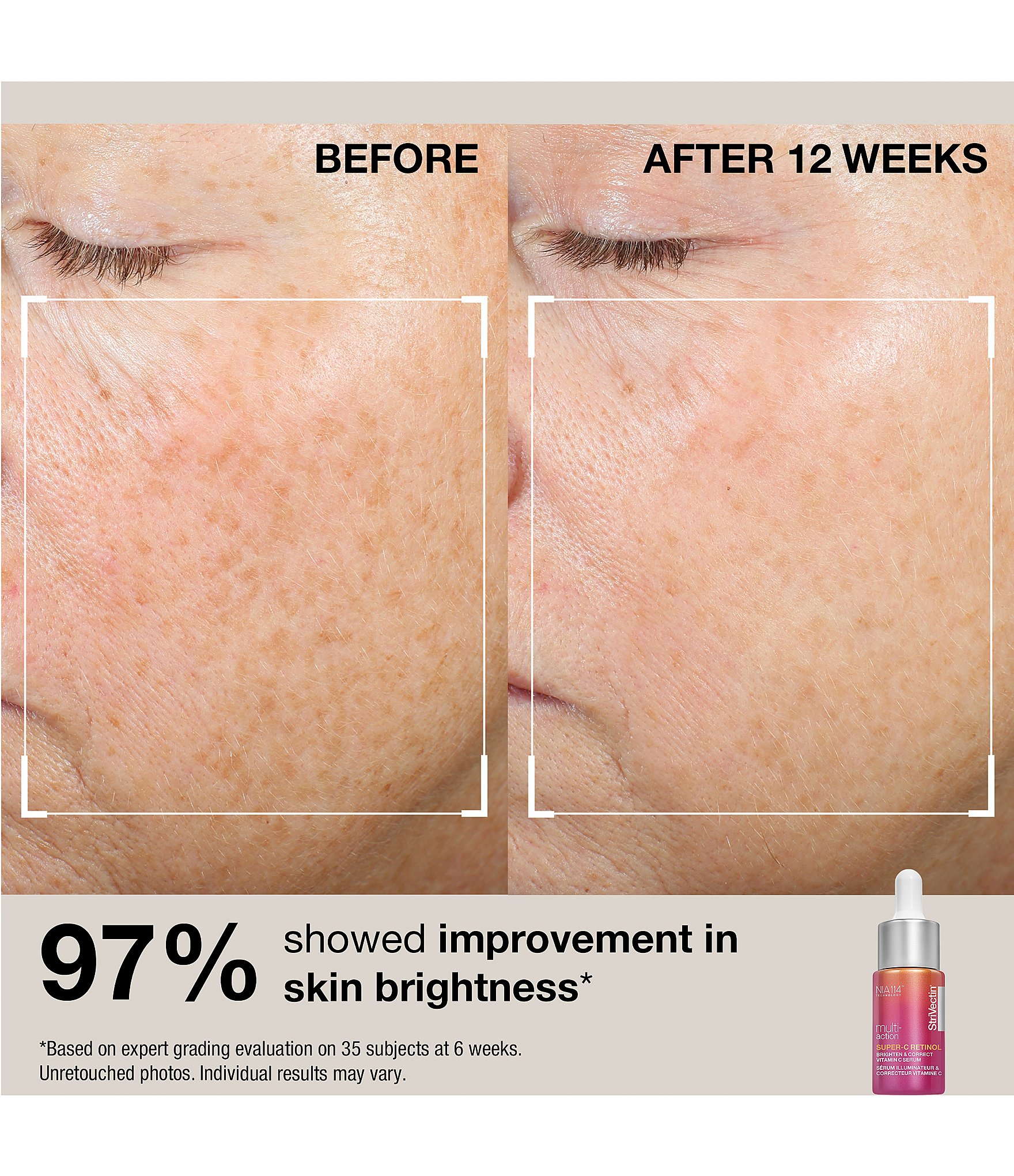 StriVectin Best & Brightest Minis Holiday Gift Set