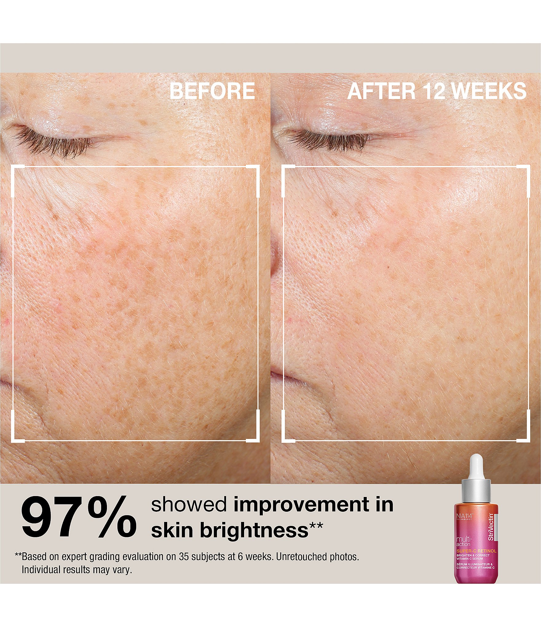 StriVectin Glow & Protect Holiday Gift Set