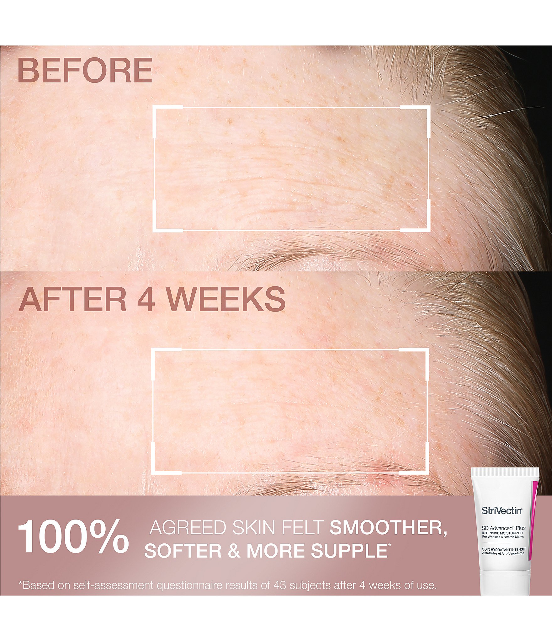 StriVectin Smooth & Hydrate Set