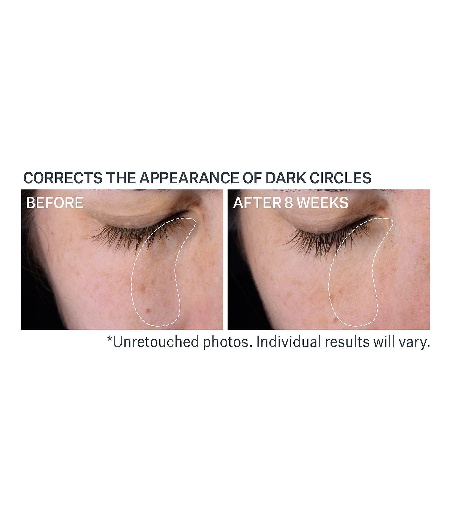 Strivectin Super C Dark Circle Brightening Eye Serum