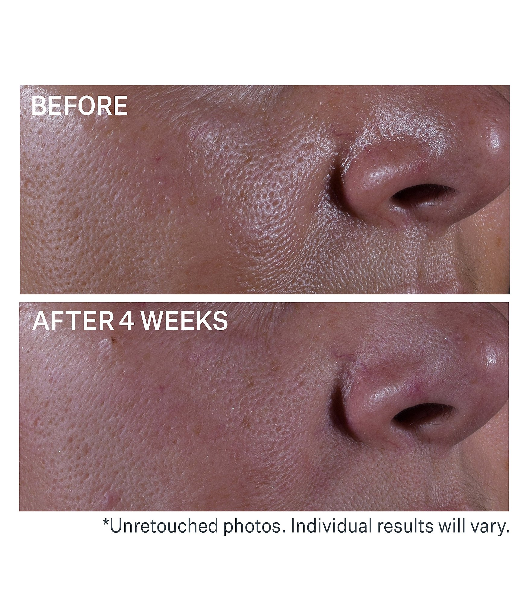 Strivectin Super Shrink Pore Minimizing Serum