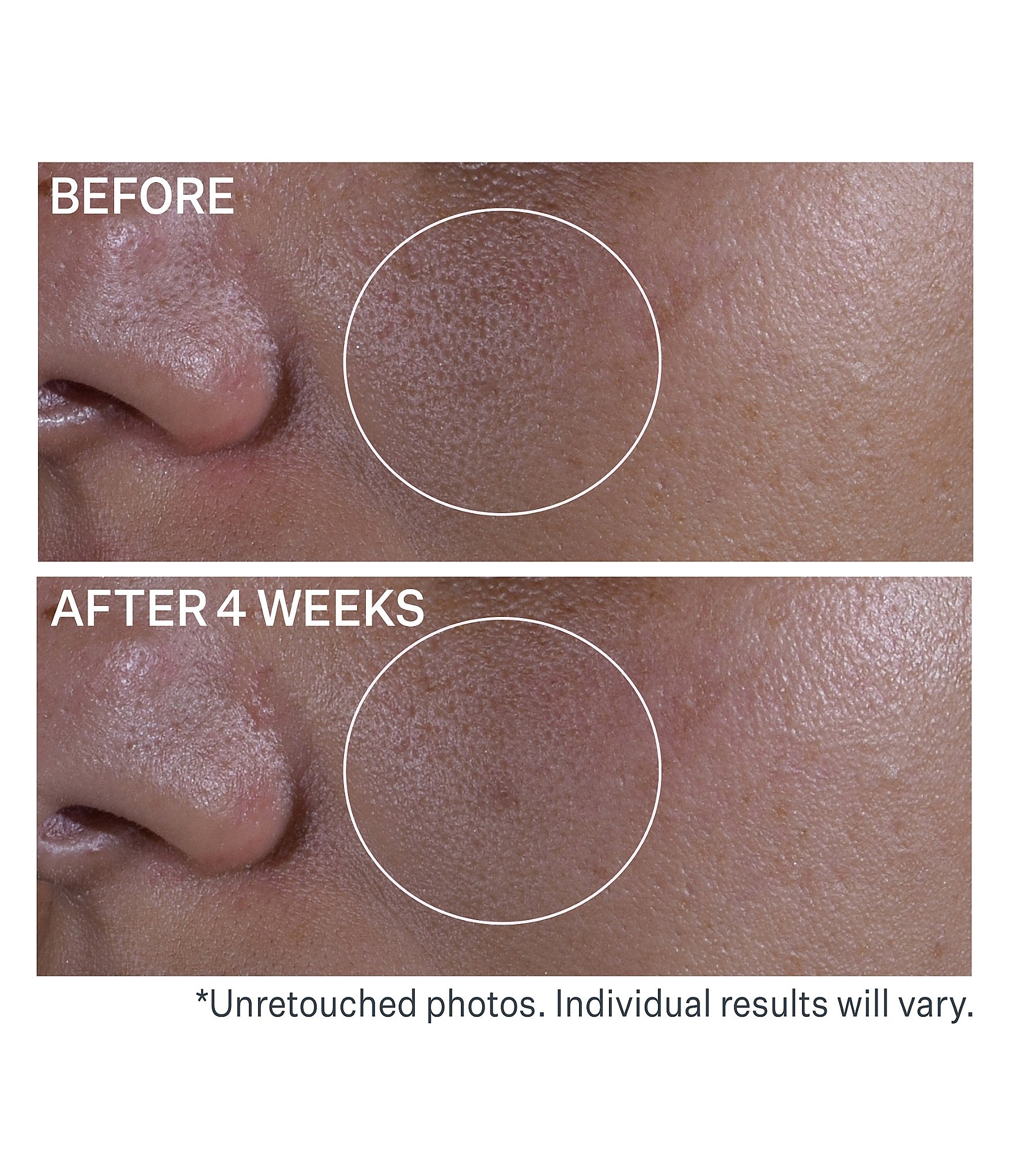 Strivectin Super Shrink Pore Minimizing Serum