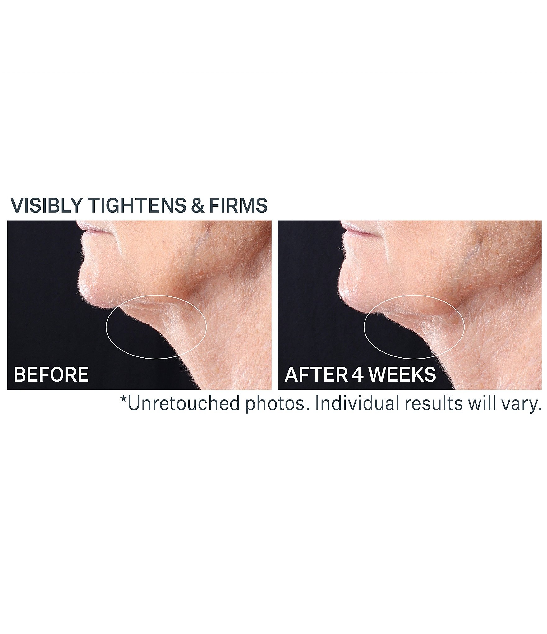 StriVectin Tighten & Lift Peptight Tightening Neck Serum Roller